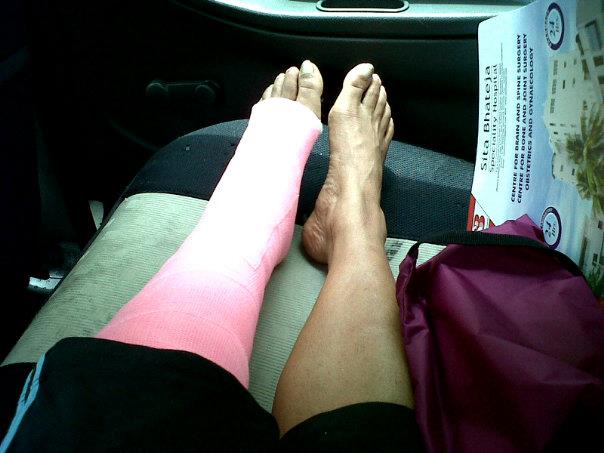 Life in a hot pink cast